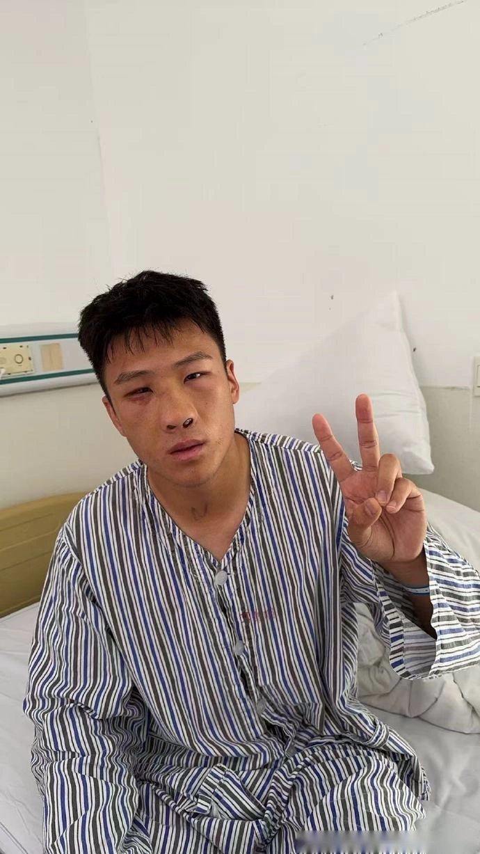 官方：赵健博已完成鼻骨复位手术，半个月后进行复查