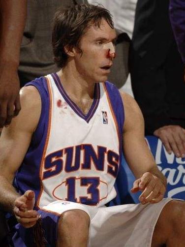 NBA球星的伤疤：罗斯的膝盖 科比的跟腱 詹姆斯的头部