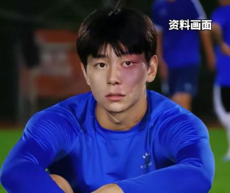 苏超庞智超：治疗胎记长期不能见阳光影响训练，所以就不治了 (http://www.busunion.cn/) 体育 第1张