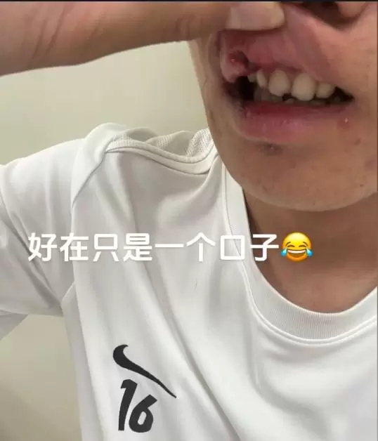张祥硕：被撞后头晕视野模糊，确实没法坚持，跟大家说声抱歉