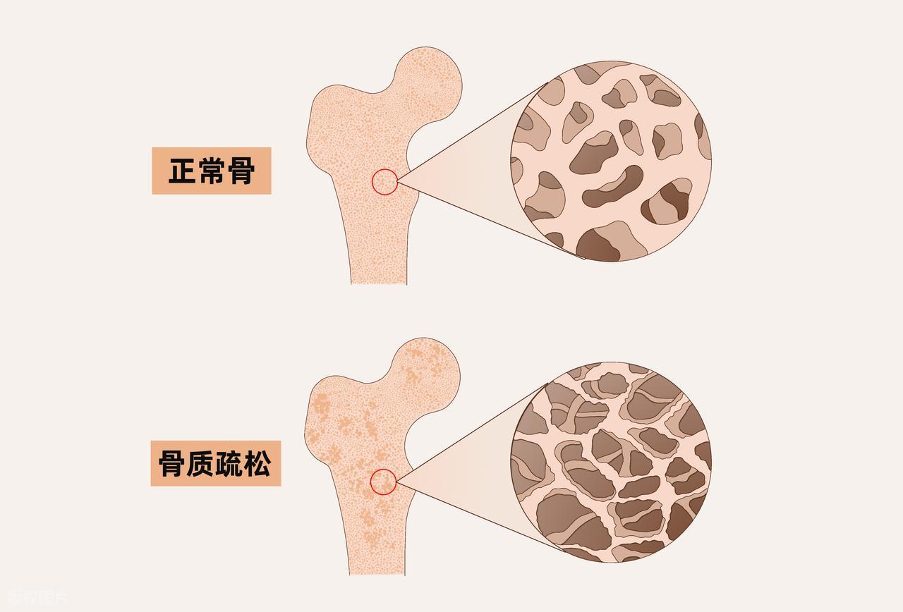 减肥为什么要多做力量训练？6个好处告诉你答案 (http://www.jingganghuifeng.com.cn/) 体育 第4张