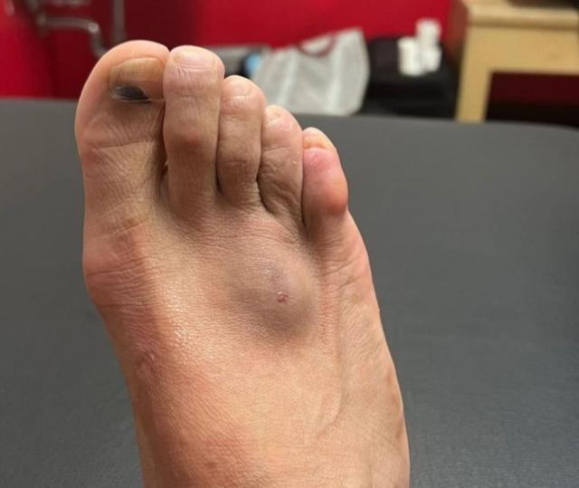 360体育-内马尔脚部受伤或缺战韩国 怕是无法过招孙兴慜了